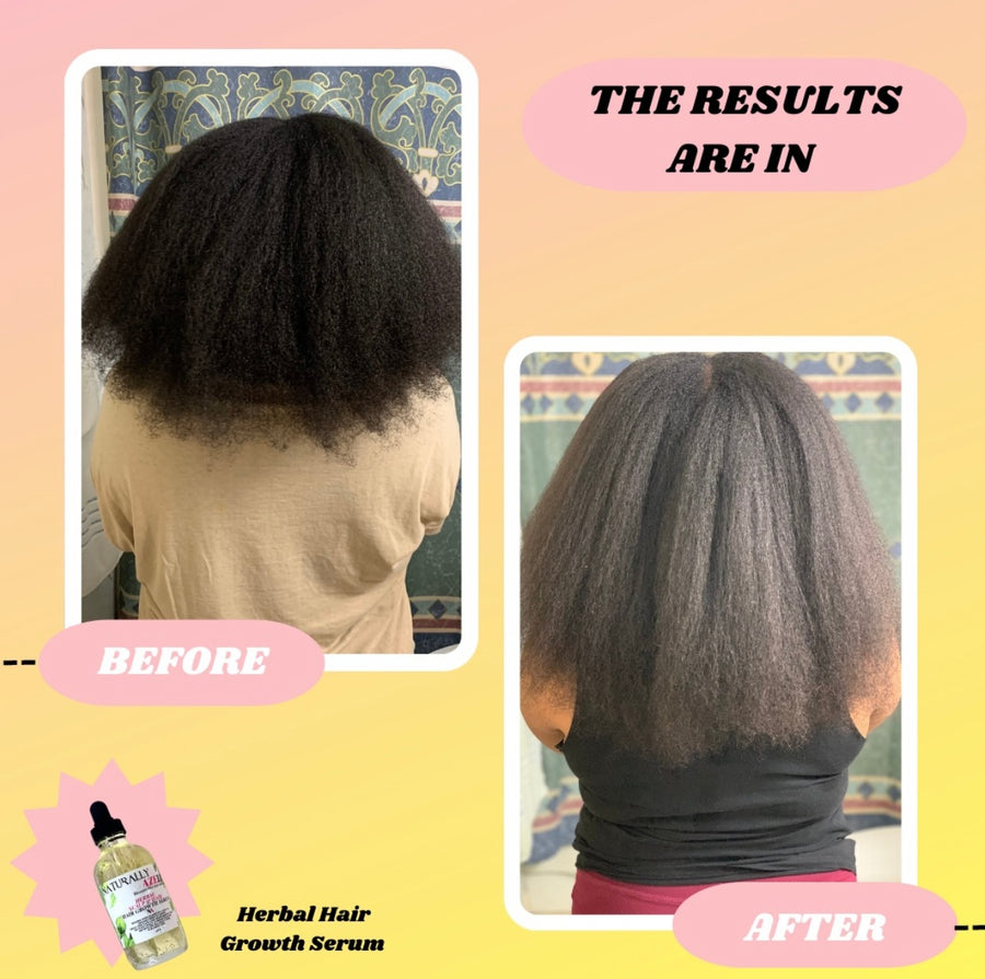 Herbal Hair Growth Serum